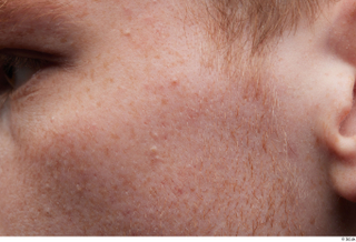 HD Face Skin Fergal cheek face skin pores skin texture…